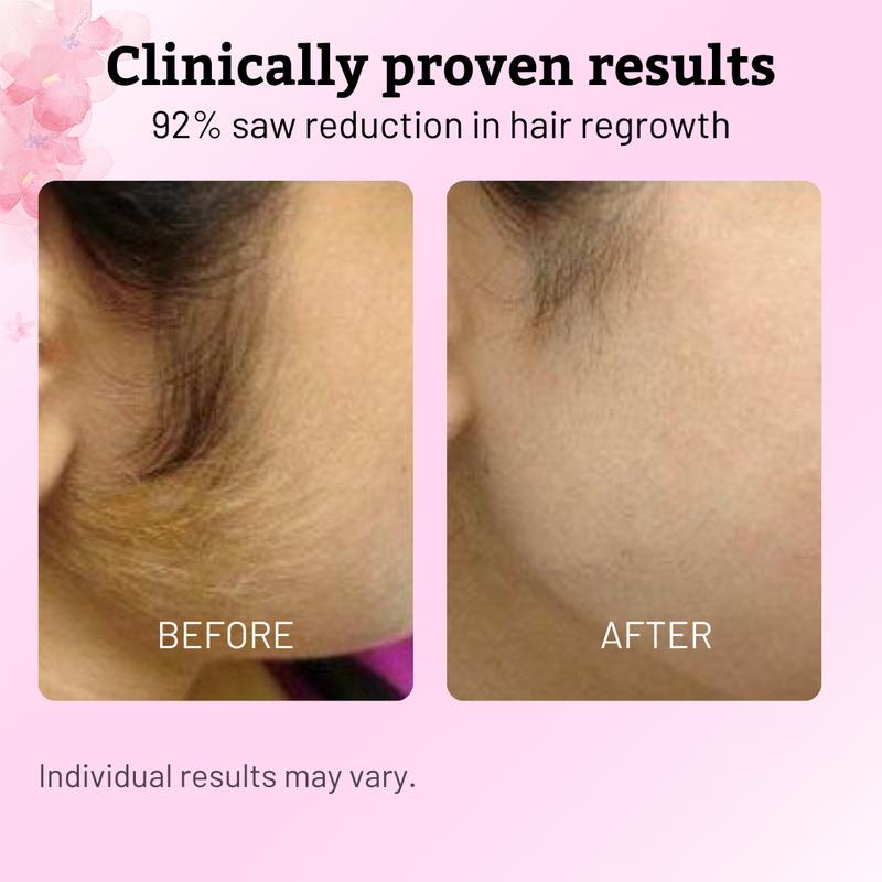 Cyperus Rotundus Hair Oil